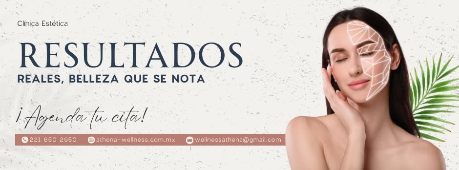 Imagen de galería